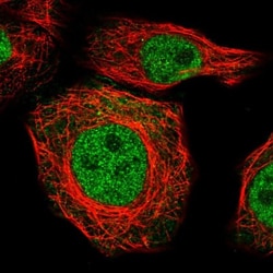 ZNF688 Antibody, Novus Biologicals:Antibodies:Primary Antibodies